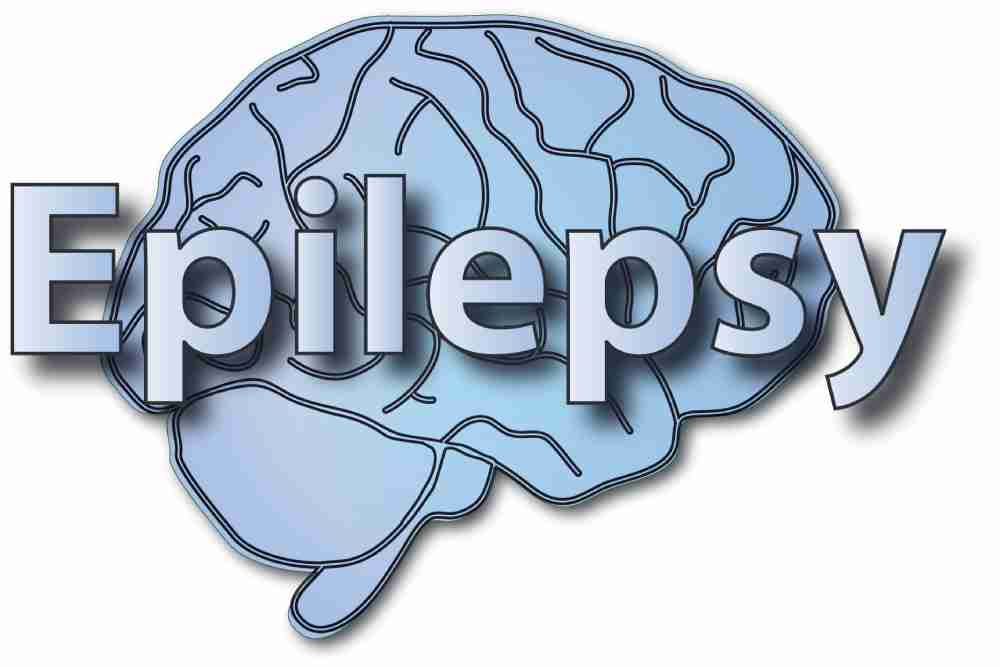 activities to avoid with epilepsy and safer alternatives